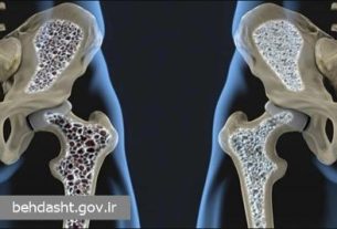 نقش تمرینات هدفمند در حفظ سلامت استخوان‌ها و پیشگیری از پوکی استخوان